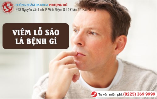 Thưa bác sĩ! Viêm lỗ sáo là bệnh gì?