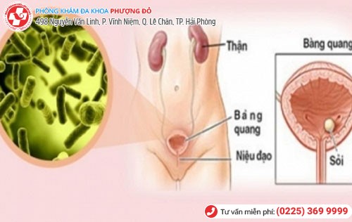 Tất cả những thông tin về viêm niệu đạo có trong bài viết này