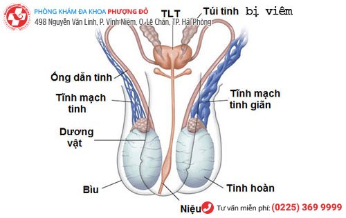 Nguy cơ vô sinh hiếm muộn do viêm túi tinh