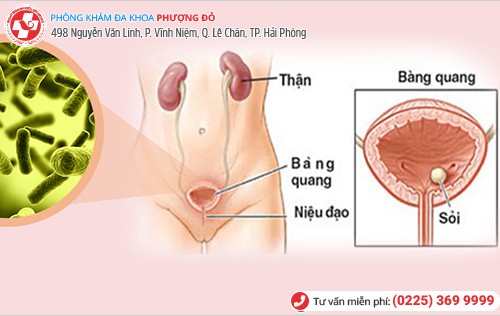 Tất tần tật thông tin về viêm đường tiết niệu