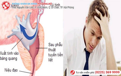 tác hại của xuất tinh ngược dòng