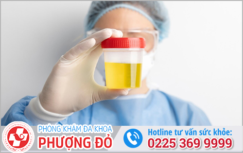 Nước tiểu vàng như nước chè thì phải làm sao?