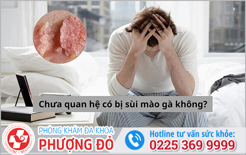 Chưa Quan Hệ Có Bị Sùi Mào Gà Không?