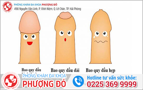 Phân biệt dài/hẹp bao quy đầu