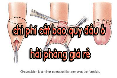 chi phí cắt bao quy đầu giá rẻ