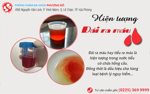 Nguyên nhân khiến nam giới đái ra máu