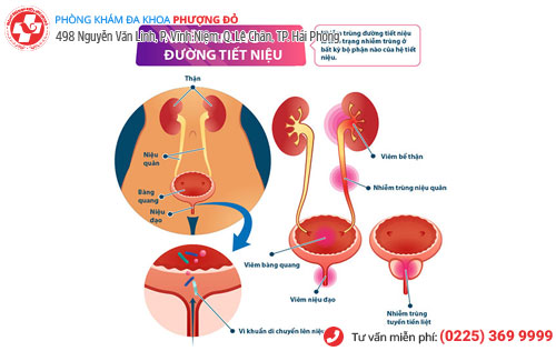 Nhiễm khuẩn đường tiết niệu ở nam giới Dấu hiệu và cách điều trị