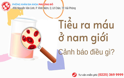 Thủ phạm gây tiểu ra máu ở nam