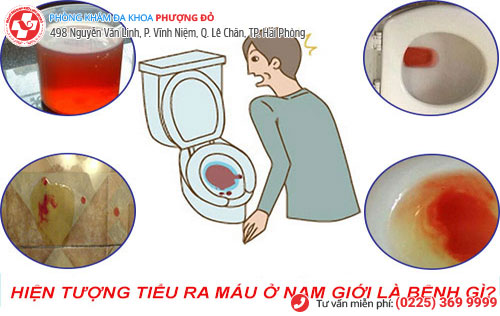 Phát hiện tiểu ra máu – Nam giới cần đặc biệt cảnh giác