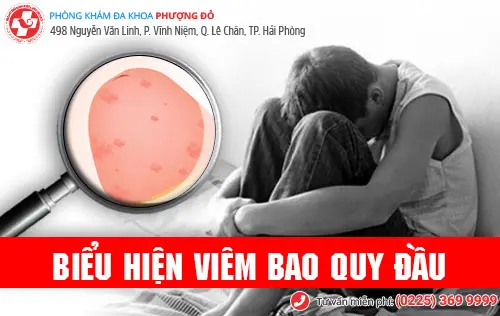 Viêm bao quy đầu là gì? Có chữa được không?